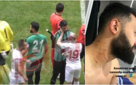 چاقوکشی یک بازیکن در لیگ فوتبال ترکیه