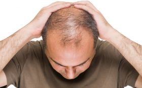 نقش کافئین در پیشگیری از ریزش مو