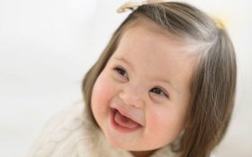 از هر هزار تولد زنده در دنیا، یک نوزاد با اختلال سندرم داون به دنیا می‌آید