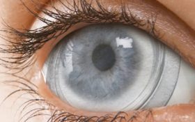تولید پانسمان چشمی با سلول بنیادی جفت جنین