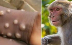 آبله میمونی، ویروسی بدون جهش‌های طولانی مدت/ بیمارستان‌ها بخش‌های ایزوله تنفسی را احیا کنند