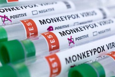 ذخایر واکسن آبله میمون در اختیار آمریکا