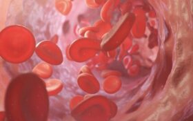 درمان جدید برای مقابله با سرطان خون کودکان