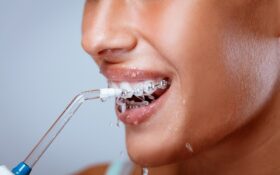 واتر جت یا مسواک مسئله این است!