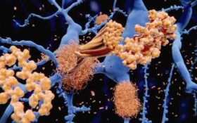 امید تازه برای درمان آلزایمر: بیماری در موش‌ها با نانوذرات کاملاً درمان شد