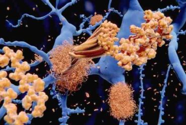 امید تازه برای درمان آلزایمر: بیماری در موش‌ها با نانوذرات کاملاً درمان شد