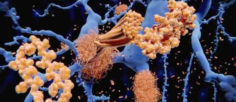 امید تازه برای درمان آلزایمر: بیماری در موش‌ها با نانوذرات کاملاً درمان شد
